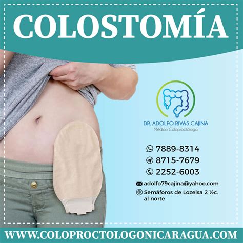 colostomía permanente.